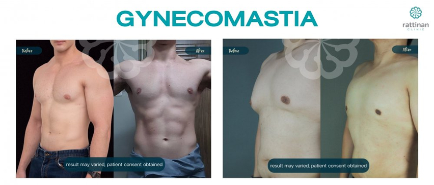 Slider image (3) Calming Confidence in Plastic Surgery at Rattinan Thailand